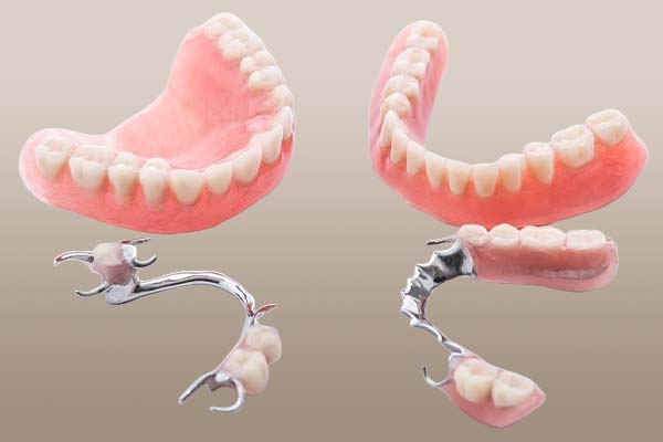 Tooth extraction procedure